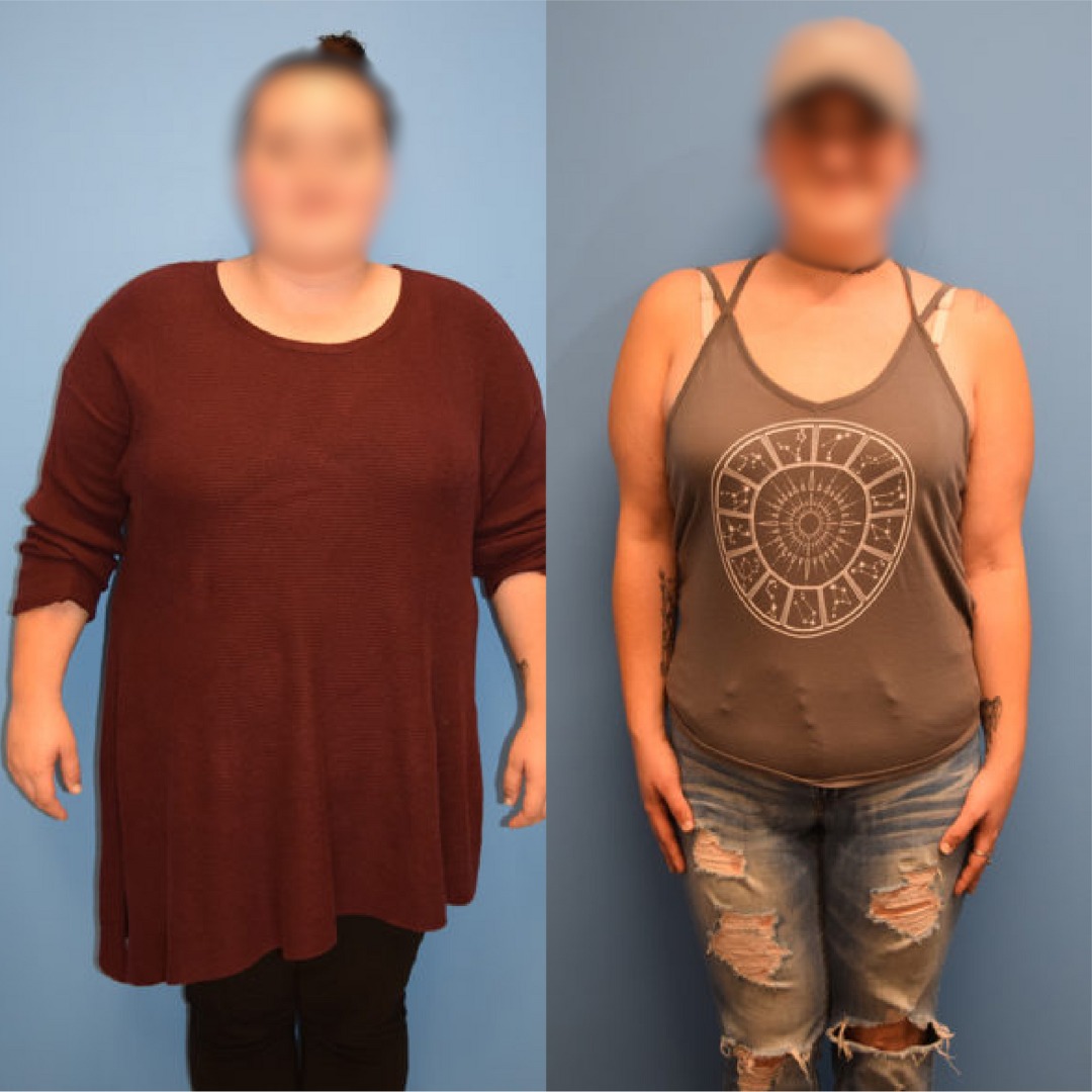 Before After 1